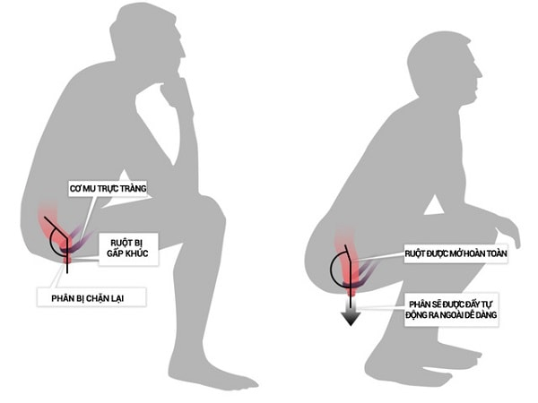 Chọn mua bệt xí tốt cho sức khỏe